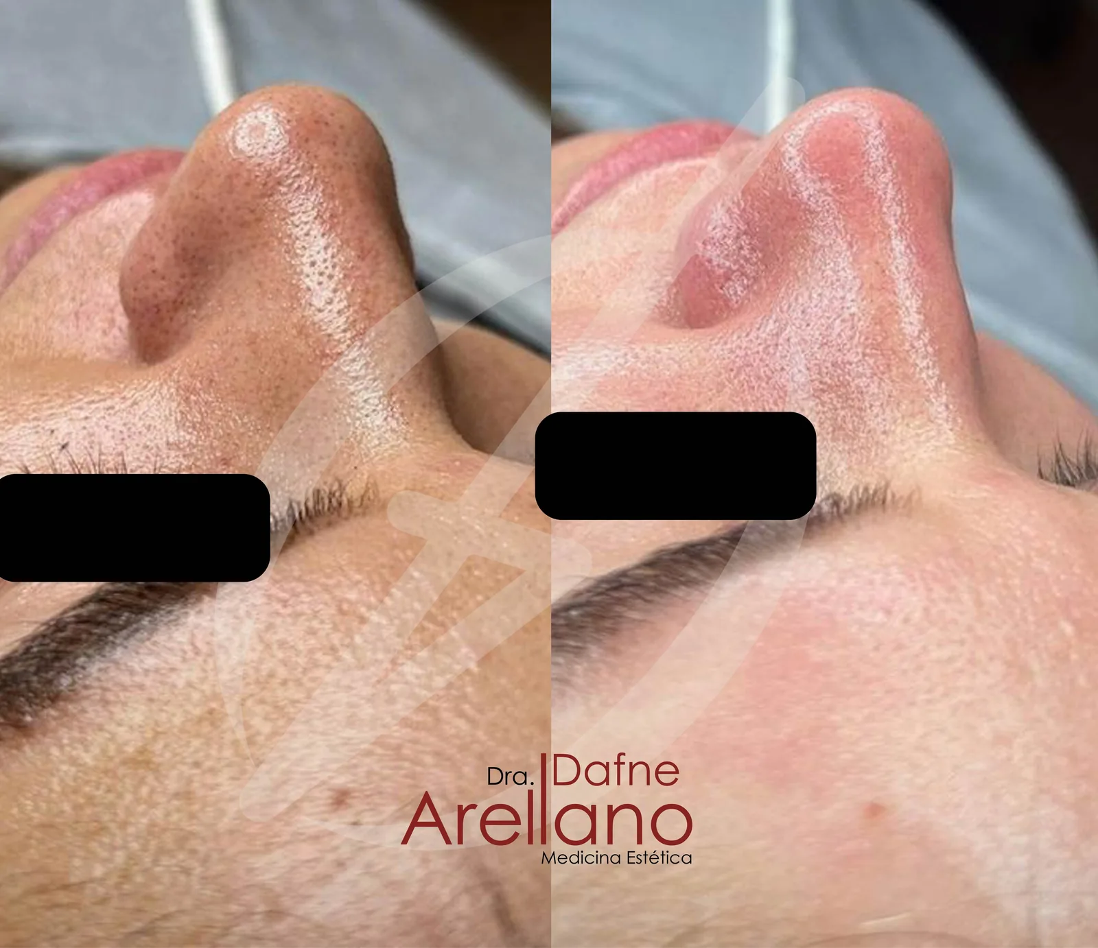 Antes y después · Facial Deluxe Casmara