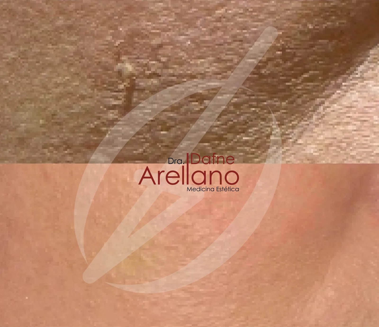 Antes — Geneo Facial Oxigenante en Puebla
