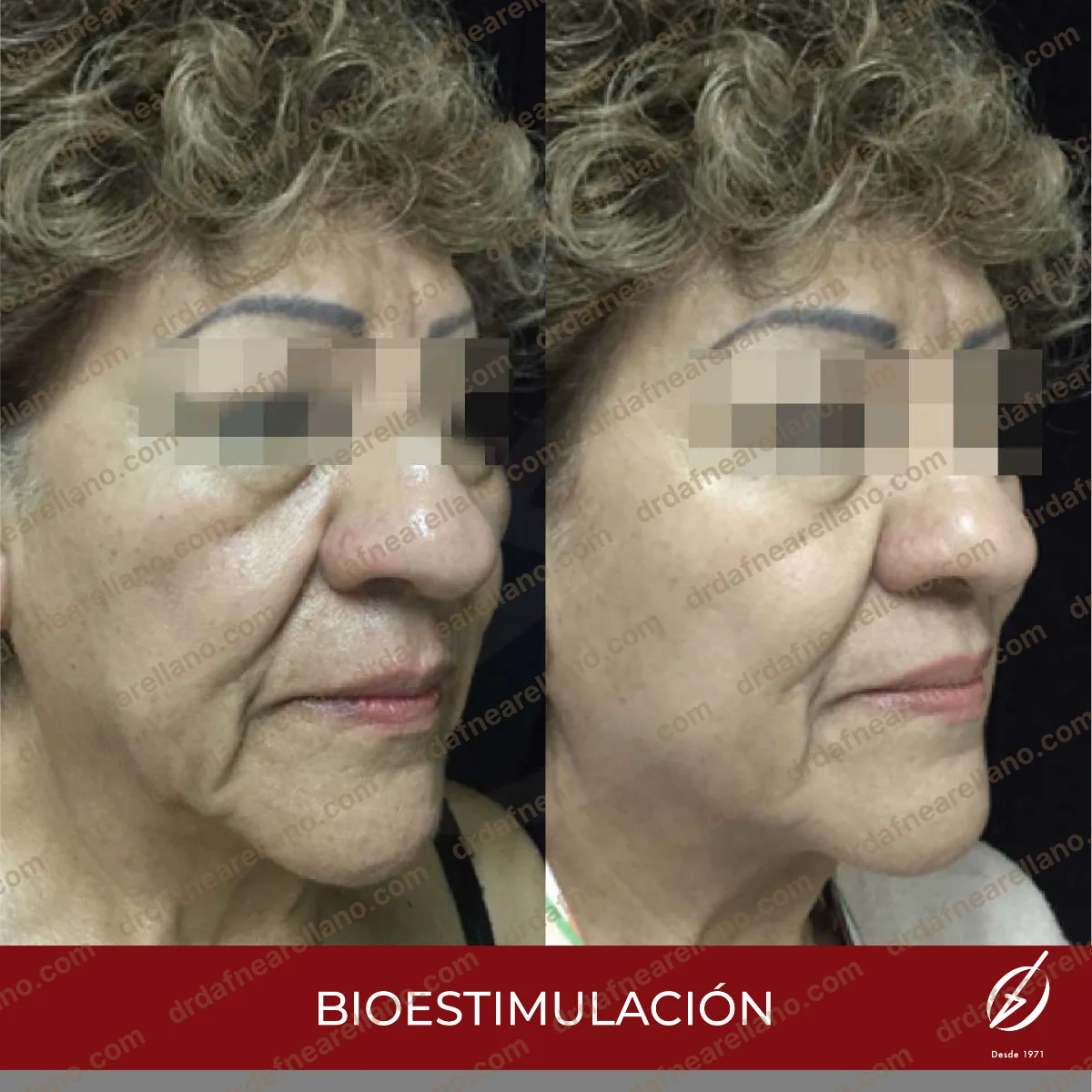 Antes y después — HArmonyCa en Puebla